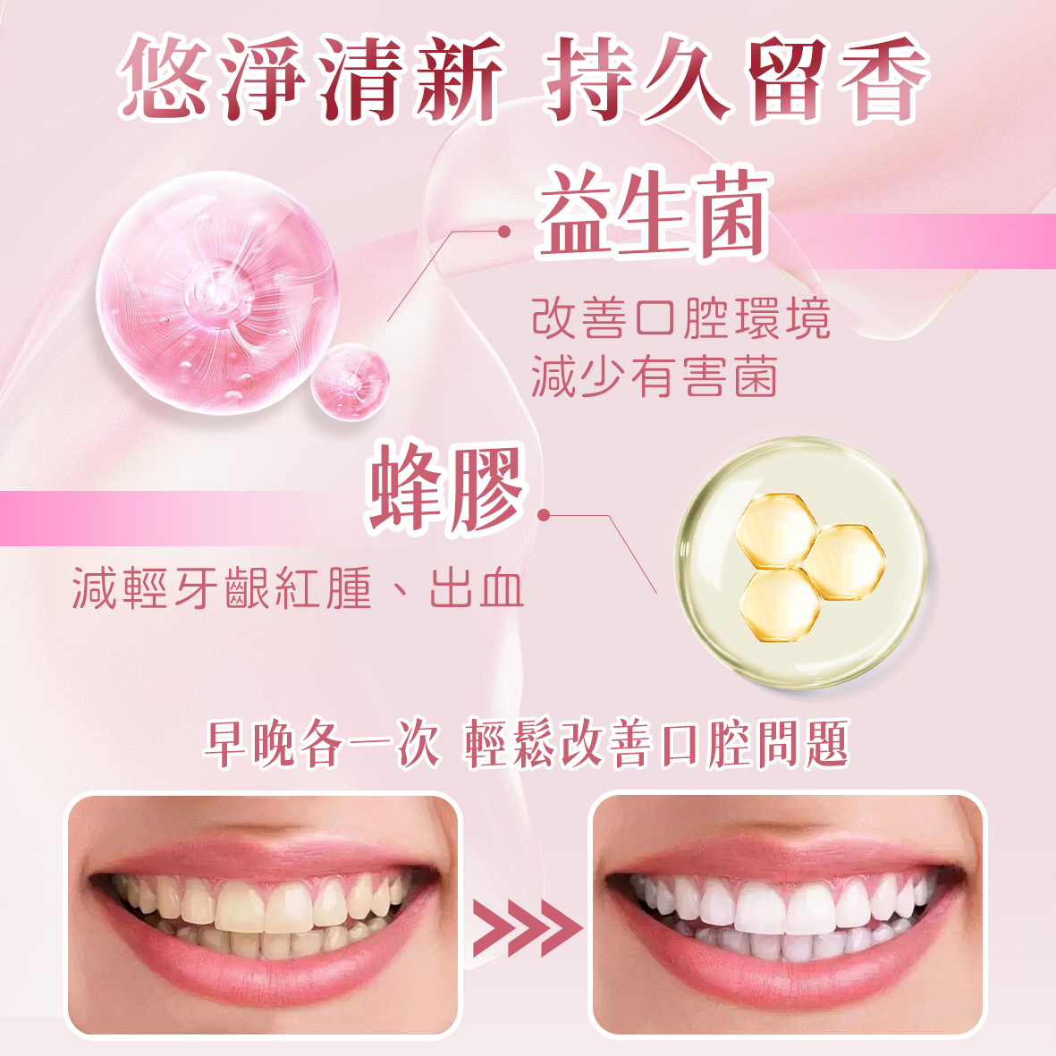 🪥 MIZU 清新益生菌蜂膠牙膏 🍯🌿