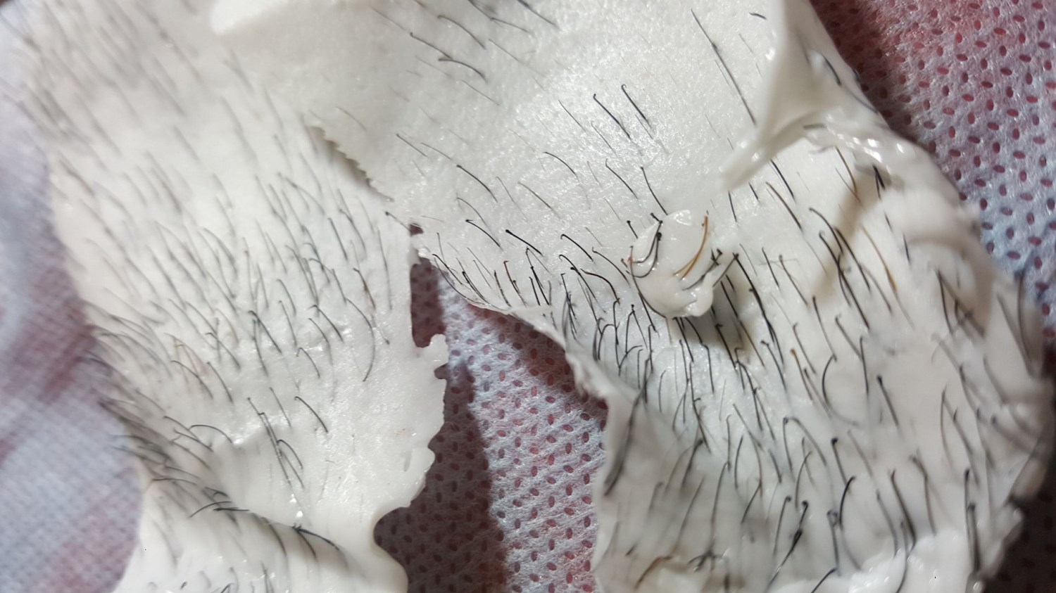 熱蠟除毛可以將毛連根拔起不留黑頭 這是連雷射除毛和除毛膏都無法做到的 !男性除毛首選熱蠟除毛