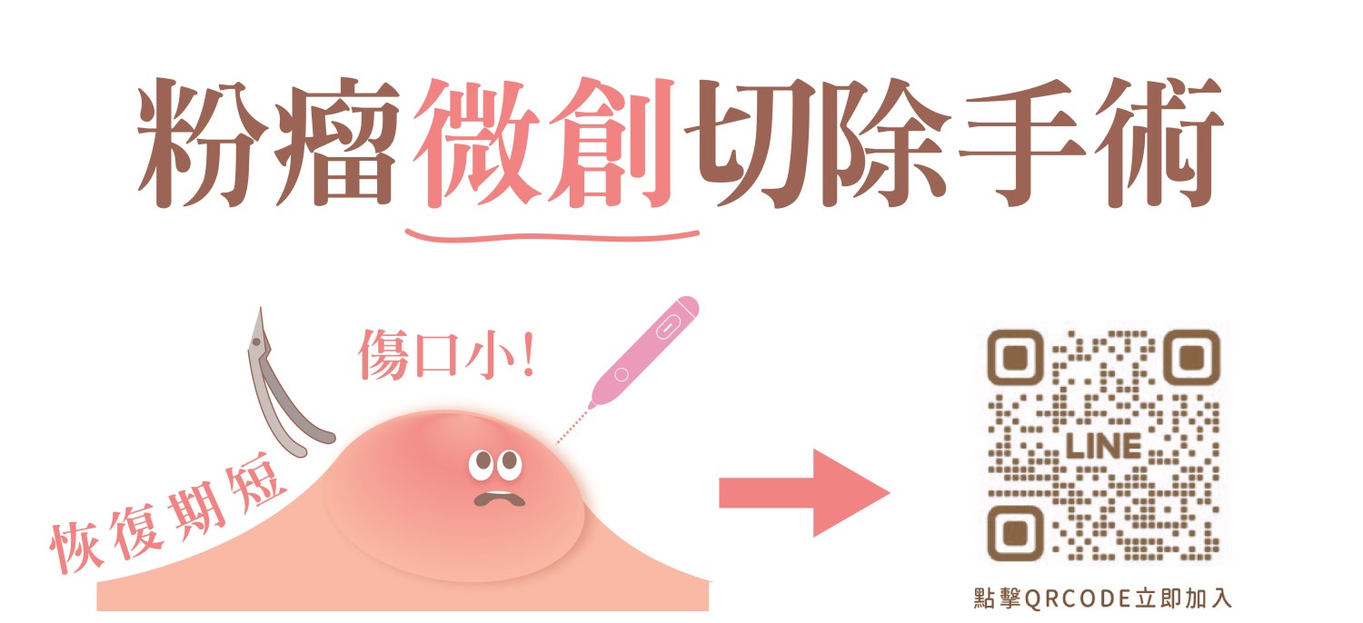 粉瘤 台中粉瘤 粉瘤手術 微創粉瘤 皮膚科 微創手術 文心極緻皮膚科診所 疤痕 