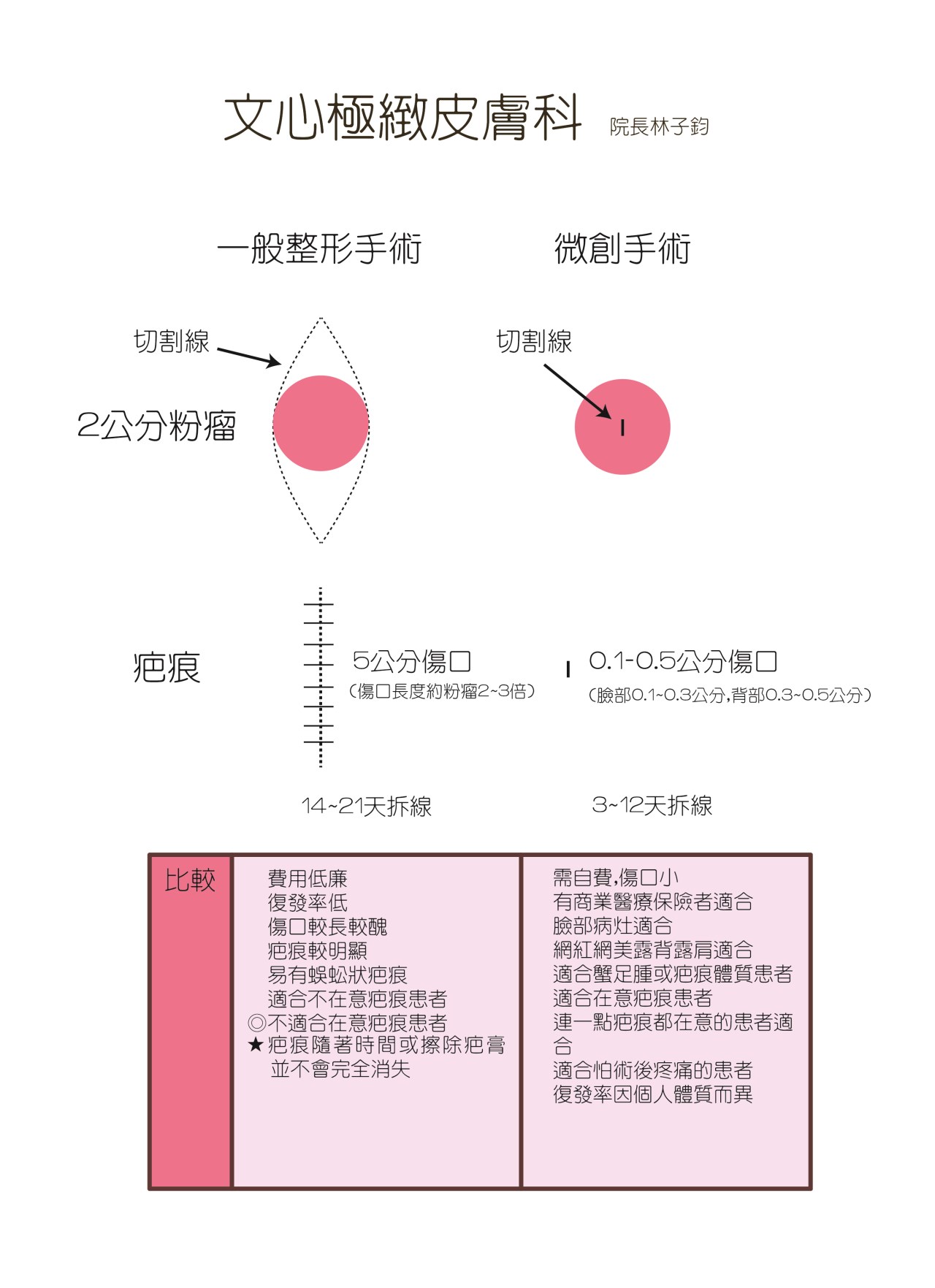 粉瘤 台中粉瘤 粉瘤手術 微創粉瘤 皮膚科 微創手術 文心極緻皮膚科診所 疤痕 